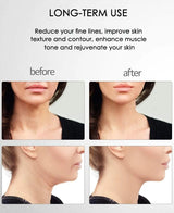 Skinlift™ - Dé oplossing voor een strakke en gezonde huid! - Jumplein